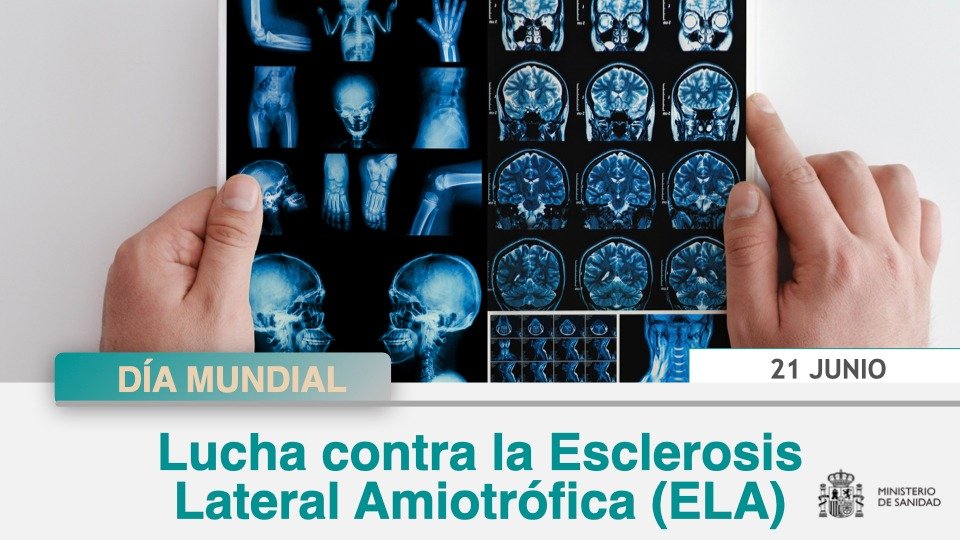 Día Mundial de la Lucha contra la Esclerosis Lateral Amiotrófica (ELA)